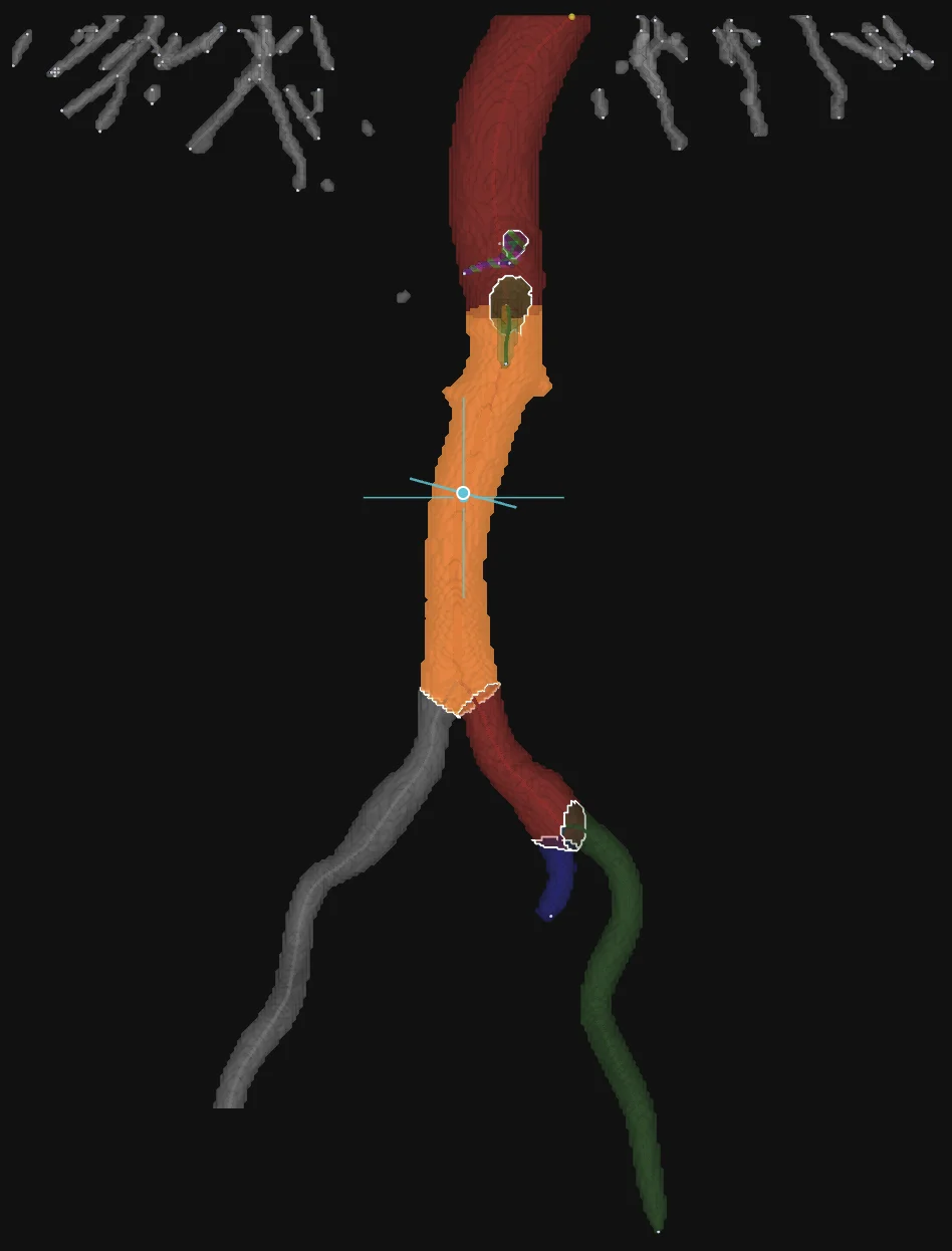 Segmentación 3D de la aorta y sus ramas por etiquetas anatómicas