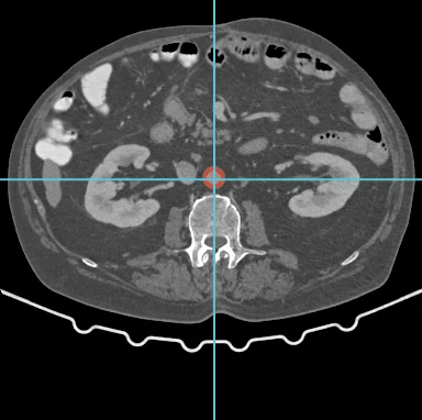 Corte axial de TC